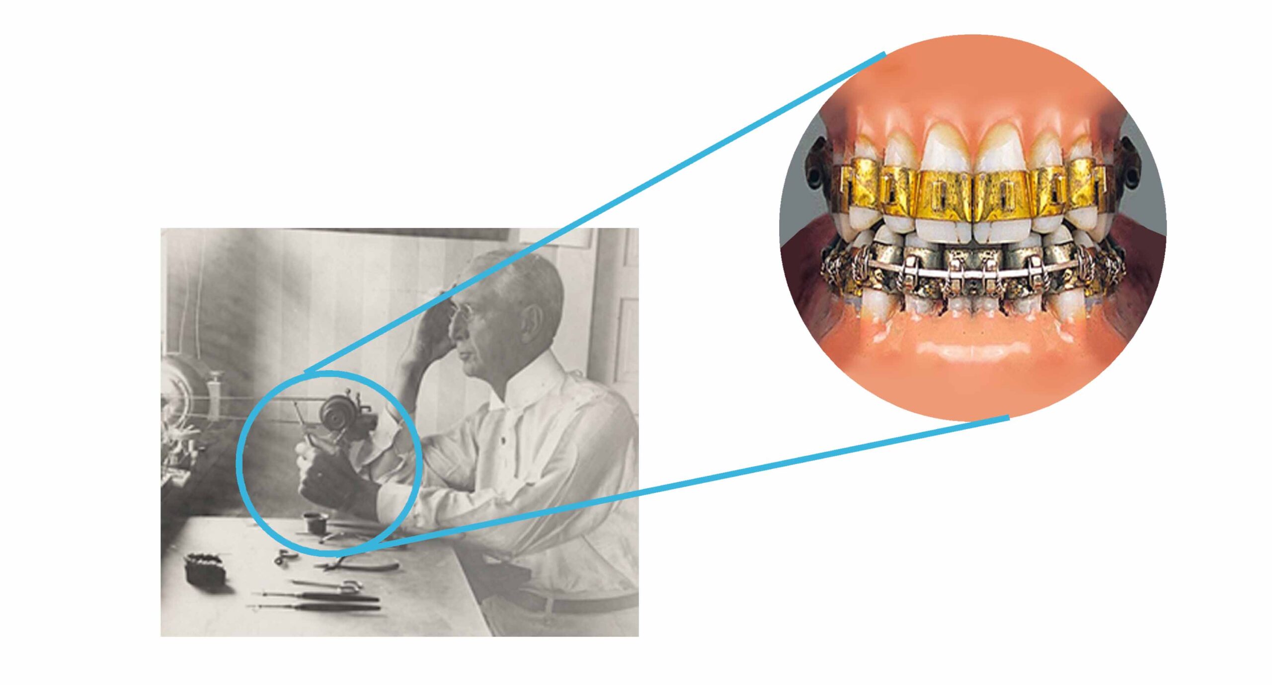 新竹牙齒矯正 有實驗精神的醫師