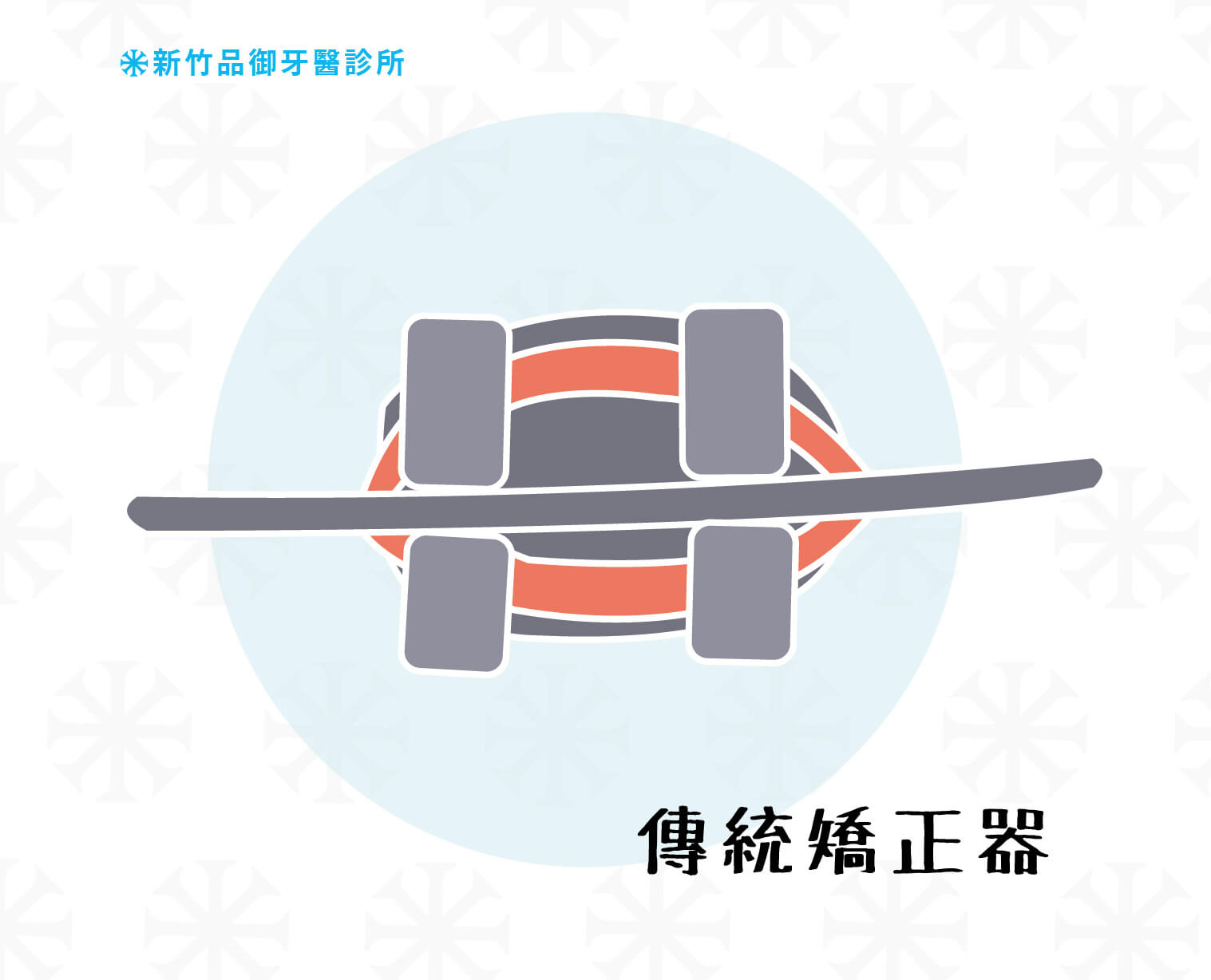 傳統綁橡皮筋的金屬矯正