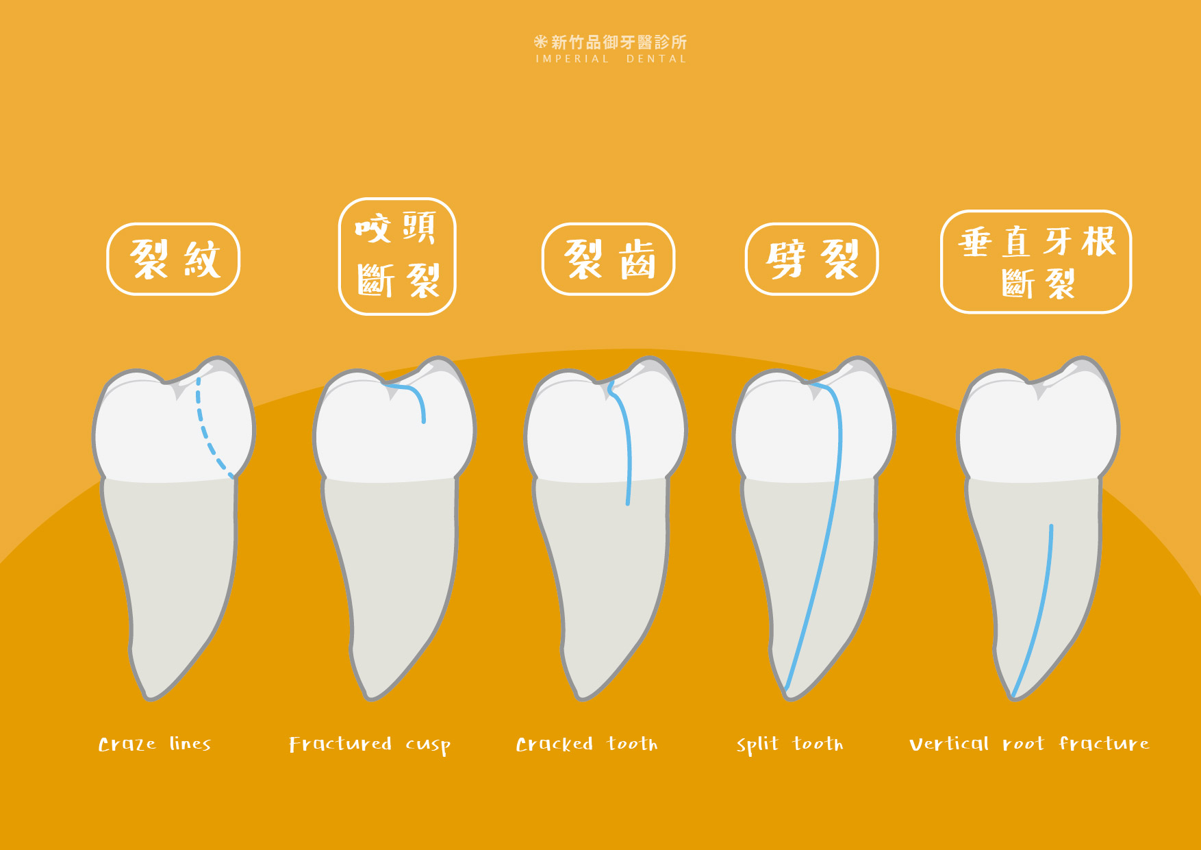 牙齒裂開五種型態