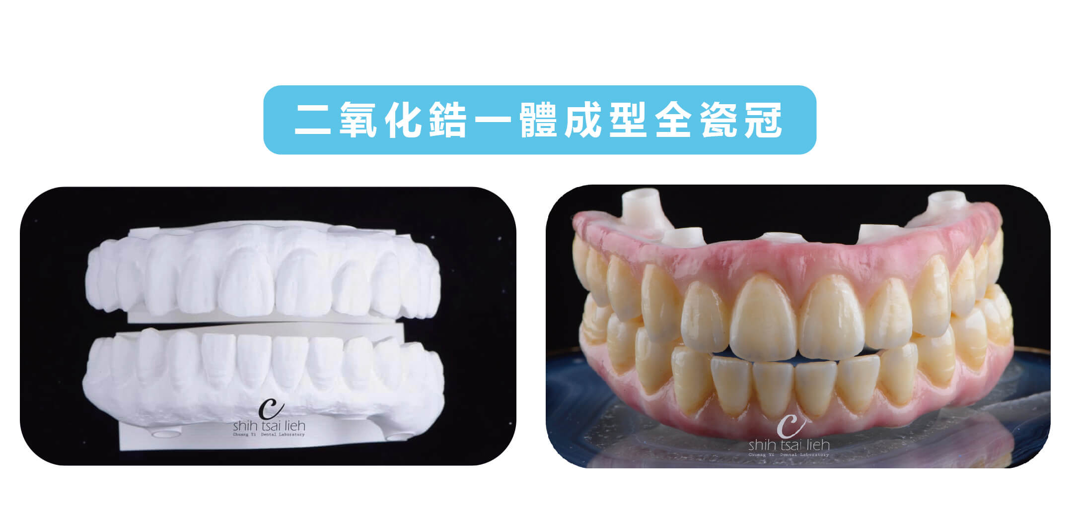 All on 4 二氧化鋯一體成型全瓷冠石膏模型