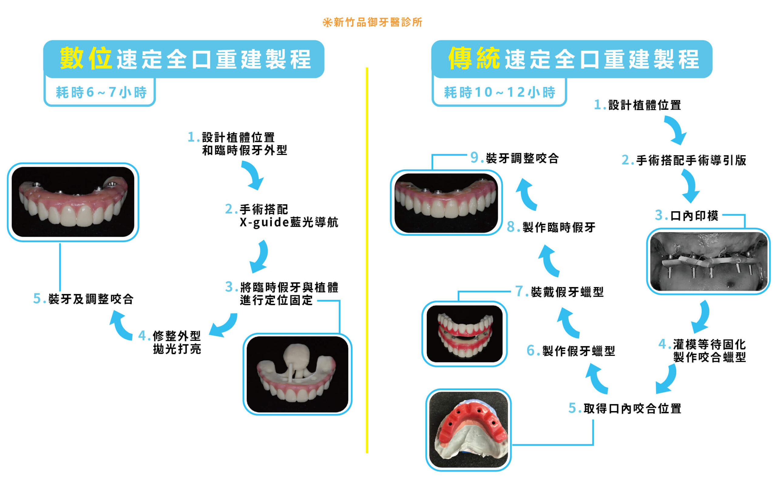 數位 All on 4 在六小時內完成