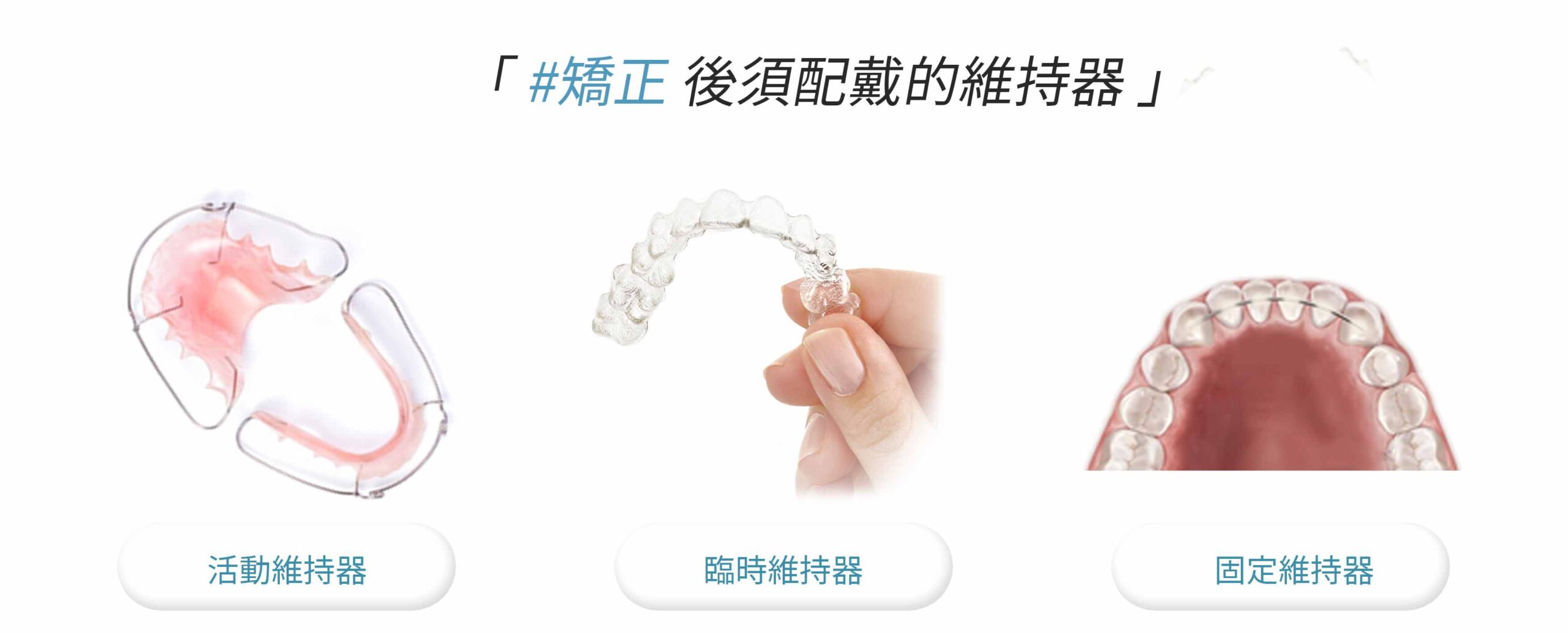 牙齒矯正後需配戴維持器