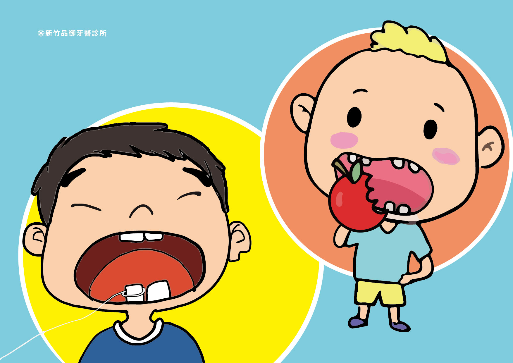 發揮創意，自行脫落。