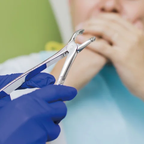 Tooth extraction