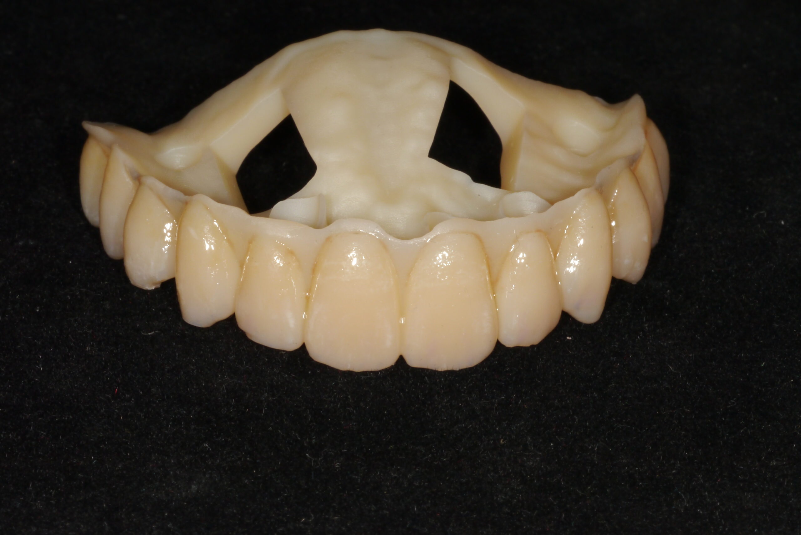 3D 立體列印全口假牙