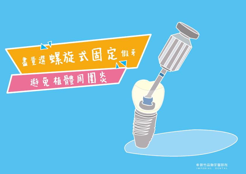 選擇螺旋式固定植牙避免植體周圍炎
