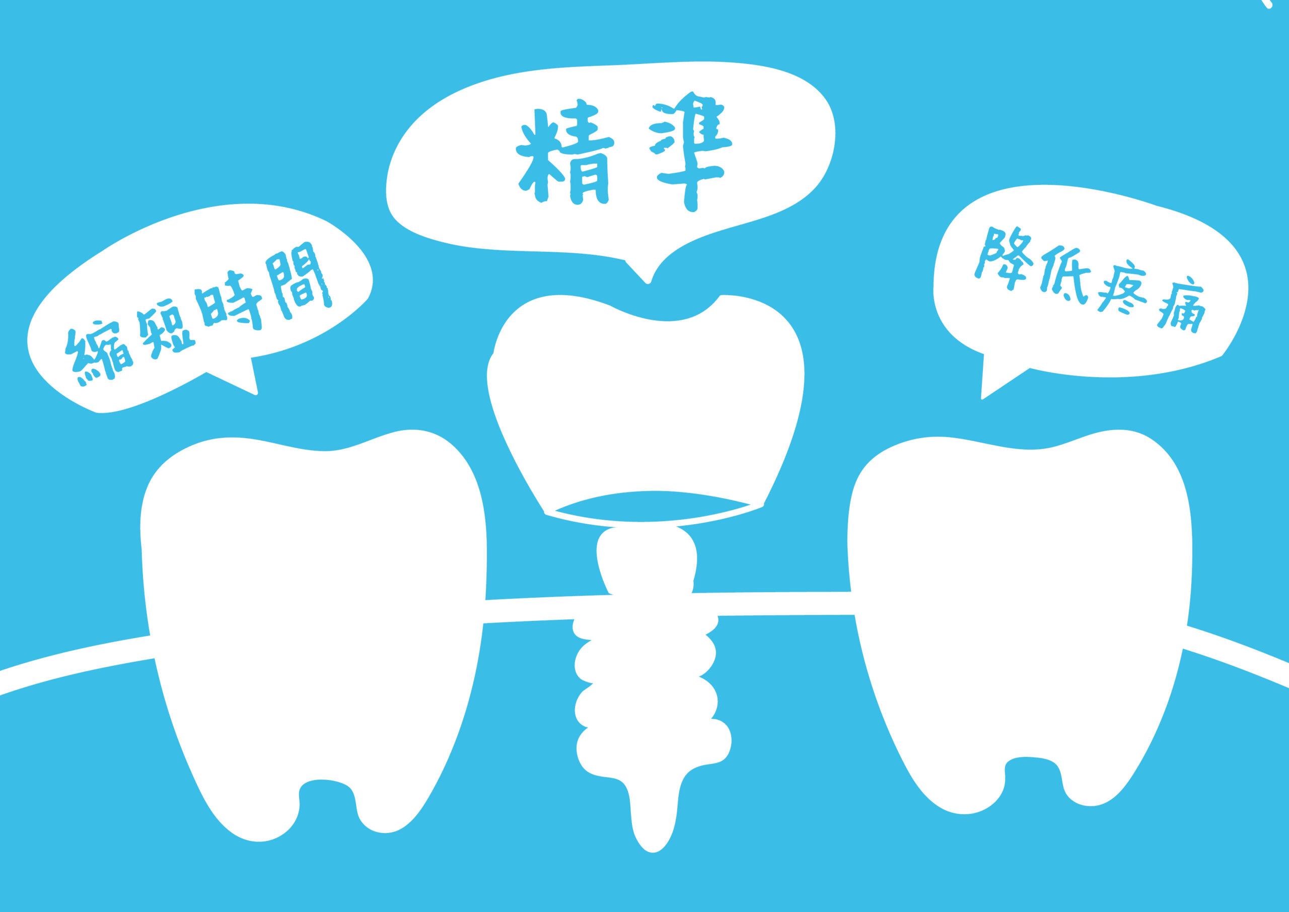 導航植牙的優點