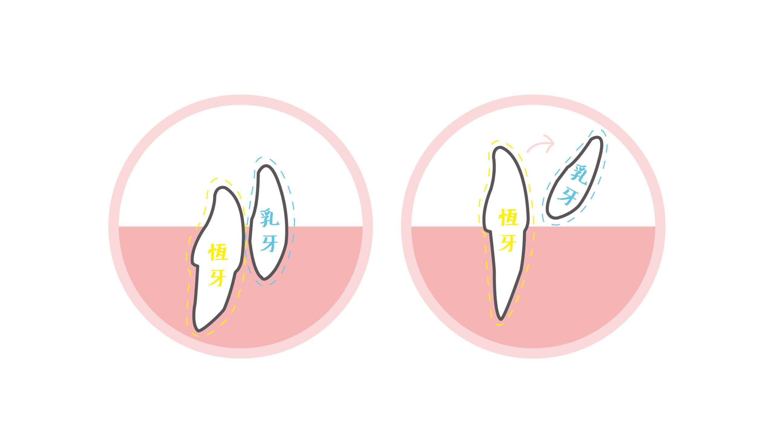 從乳牙開始掉落換成恆牙,便開始牙齒這數十年的旅程