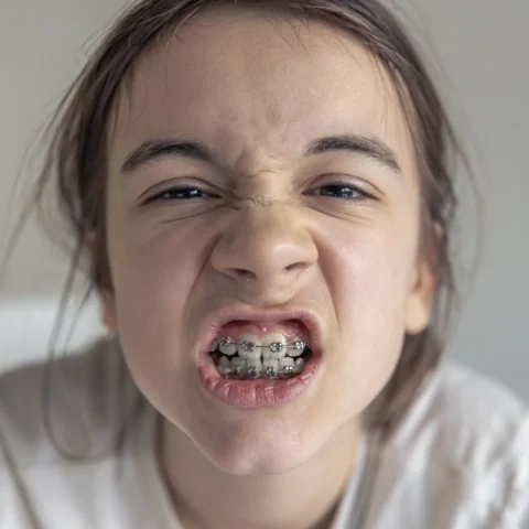 Pediatric orthodontics