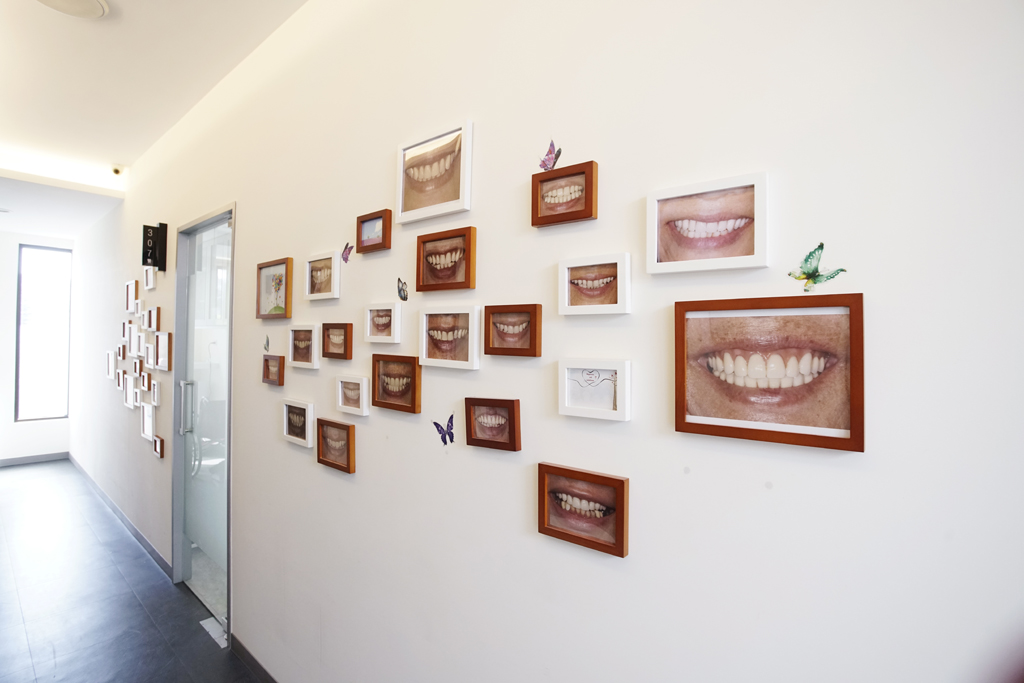 品御牙醫已有上百顎的 All-on-4 全口植牙成功案例