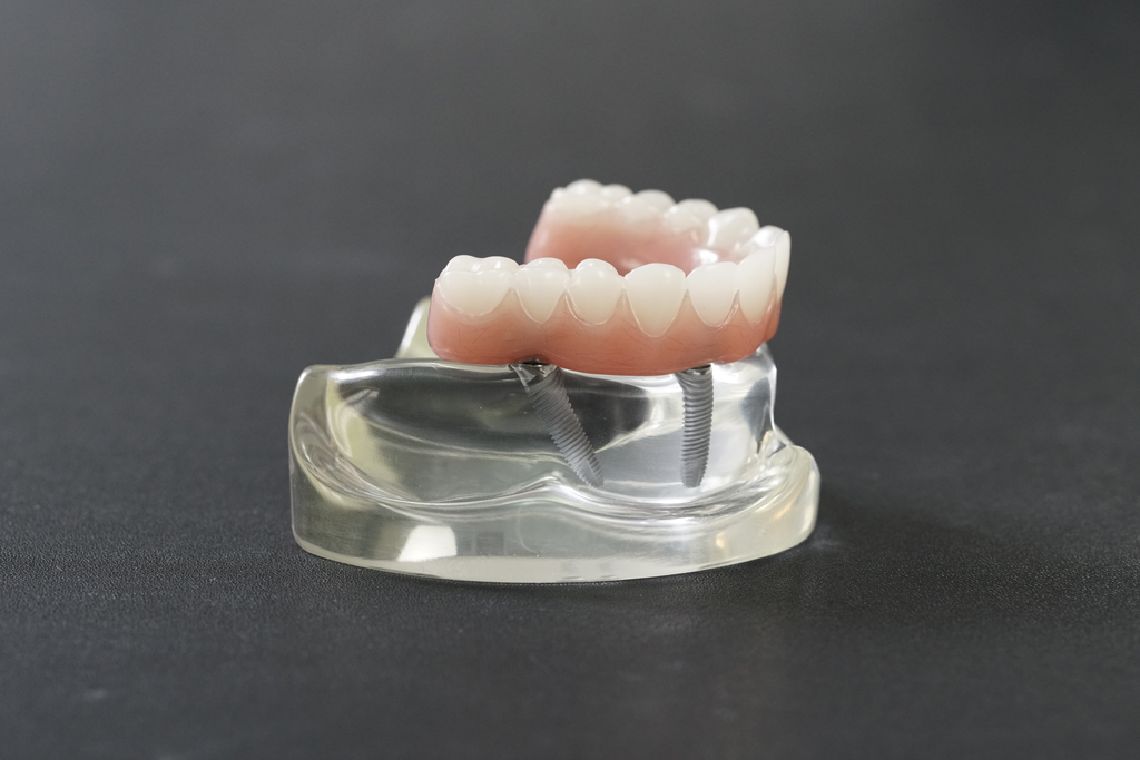 All-on-4 全口植牙假牙模型