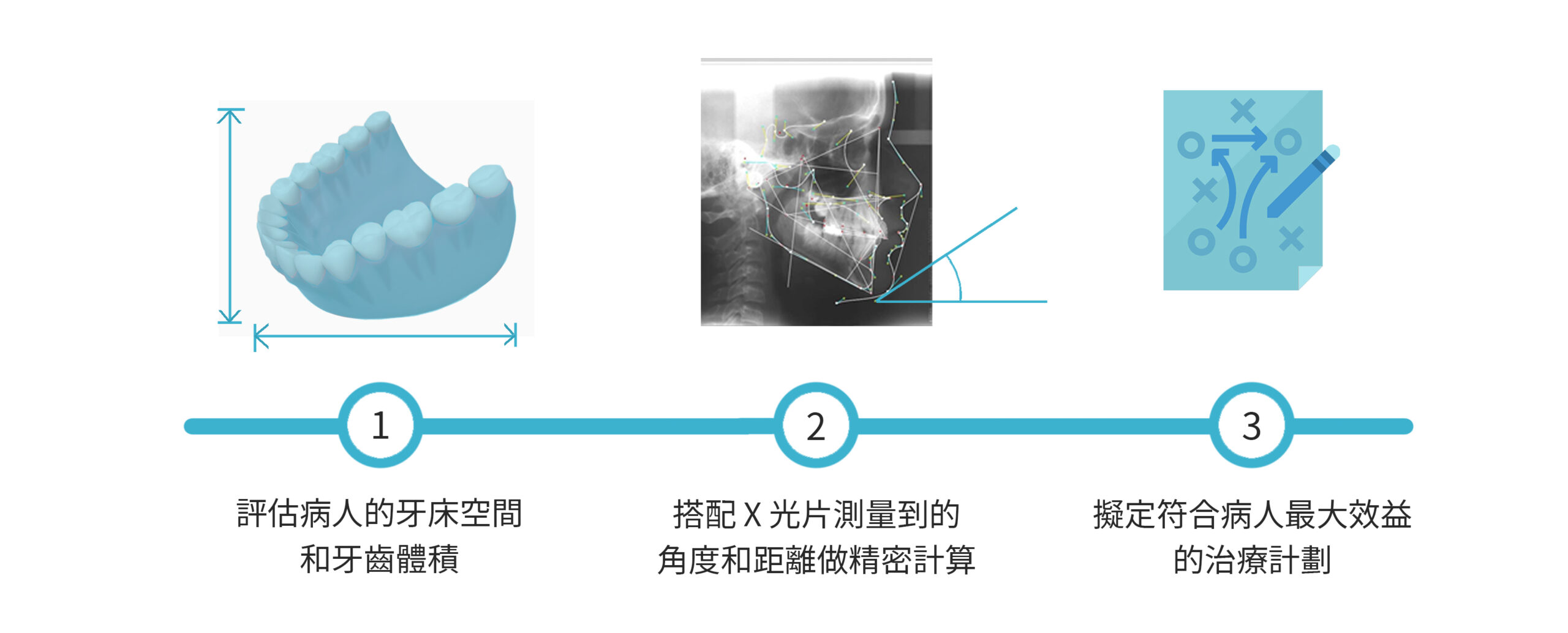 新竹牙齒矯正 牙床空間和牙齒體積