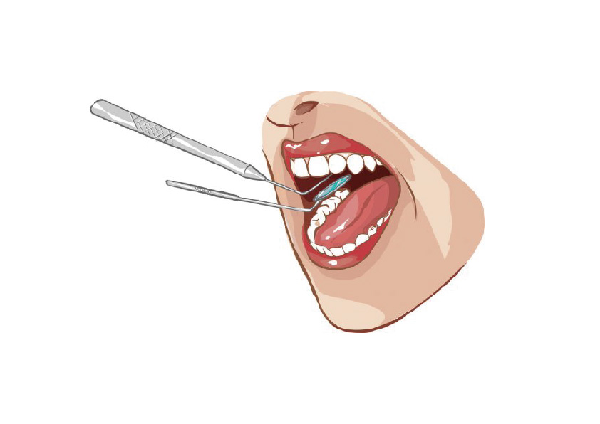 預防勝過治療，定期檢查不能少